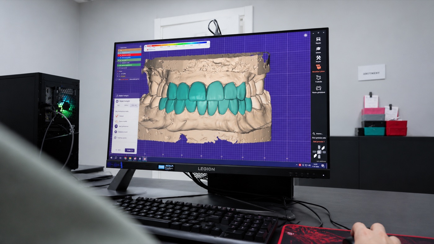 Digital design